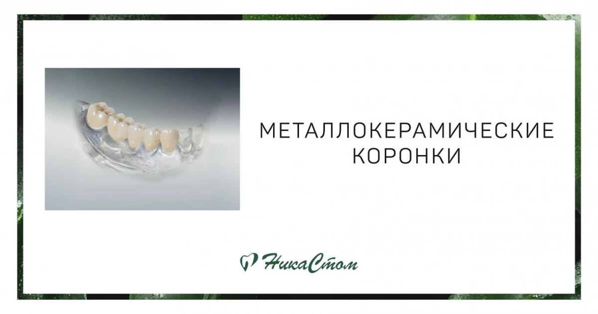 Иссечение капюшона зуба мудрости Томск Островского Николая ортодонт томск