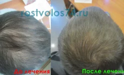 медицинский центр рост волос изображение 8 на проекте infodoctor.ru