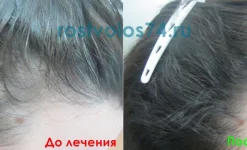 медицинский центр рост волос изображение 3 на проекте infodoctor.ru
