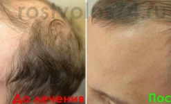 медицинский центр рост волос изображение 6 на проекте infodoctor.ru