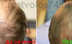 медицинский центр рост волос изображение 1 на проекте infodoctor.ru
