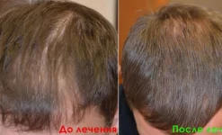 медицинский центр рост волос изображение 5 на проекте infodoctor.ru