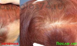 медицинский центр рост волос изображение 4 на проекте infodoctor.ru