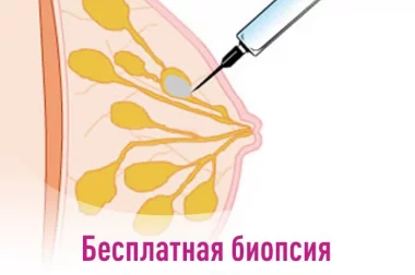 Трукат (трепан) биопсия молочной железы.