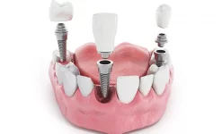 стоматология зубной стандарт изображение 5 на проекте infodoctor.ru