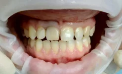 стоматологический центр зубная фея изображение 4 на проекте infodoctor.ru
